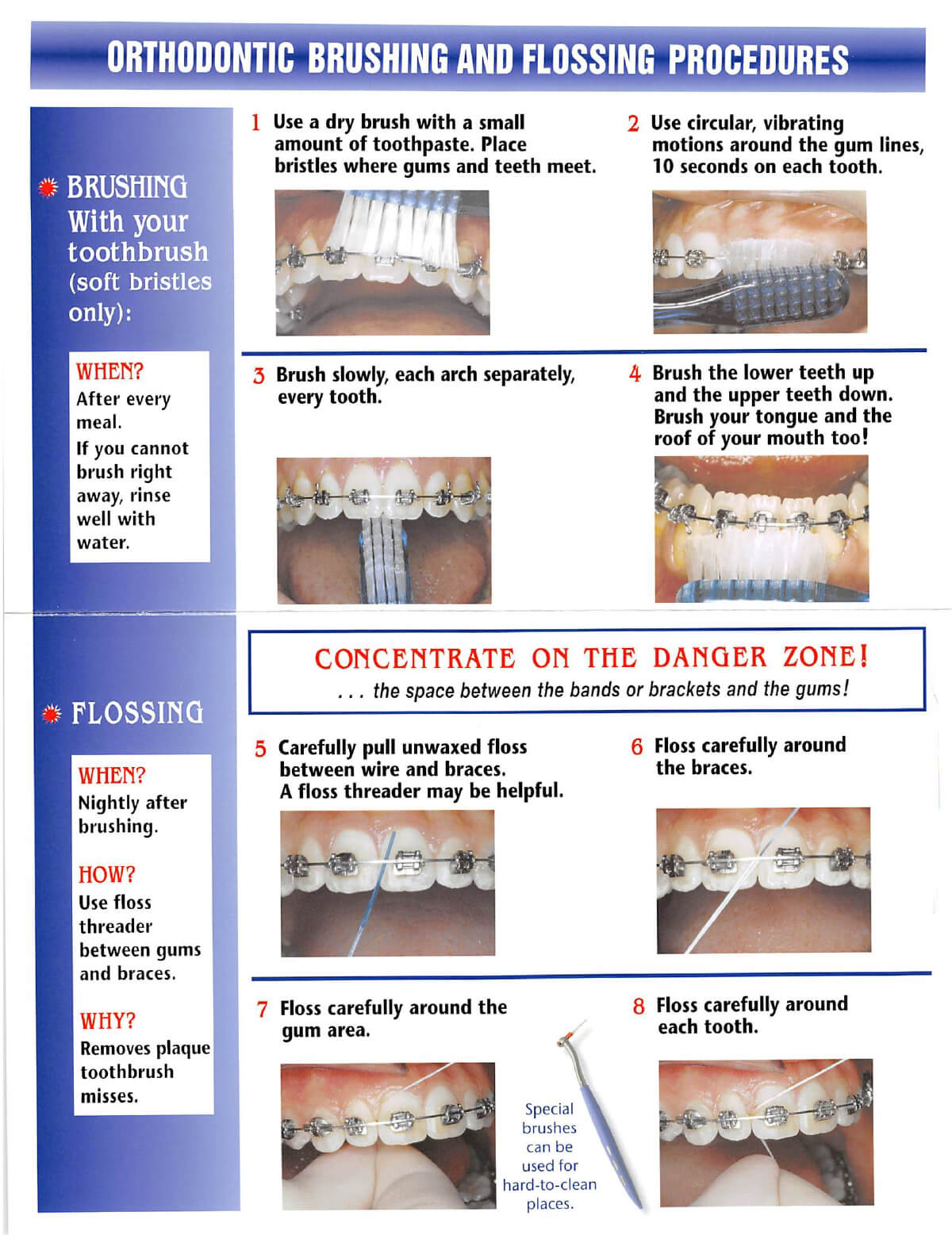 brushing technique image